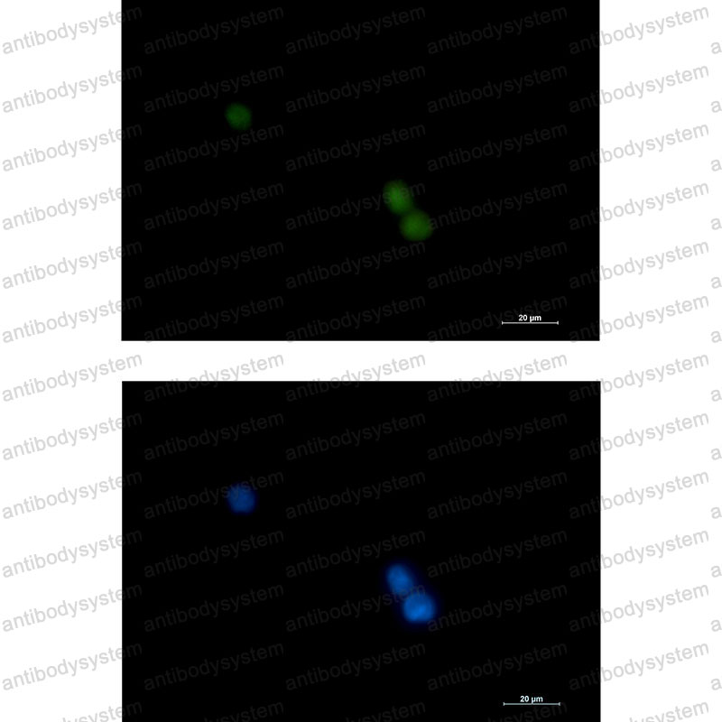 Anti-POLD1 Antibody (R1T54)