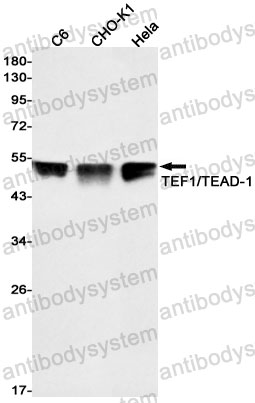 Anti-TEAD1 Antibody (R1T58)