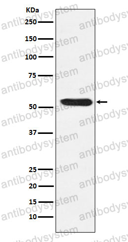 Anti-TEAD1/2/3/4 Antibody (R1T55)