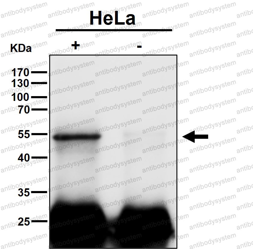 Anti-TEAD1 Antibody (R1T56)