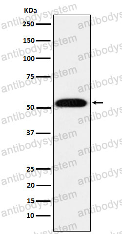 Anti-TEAD1 Antibody (R1T57)