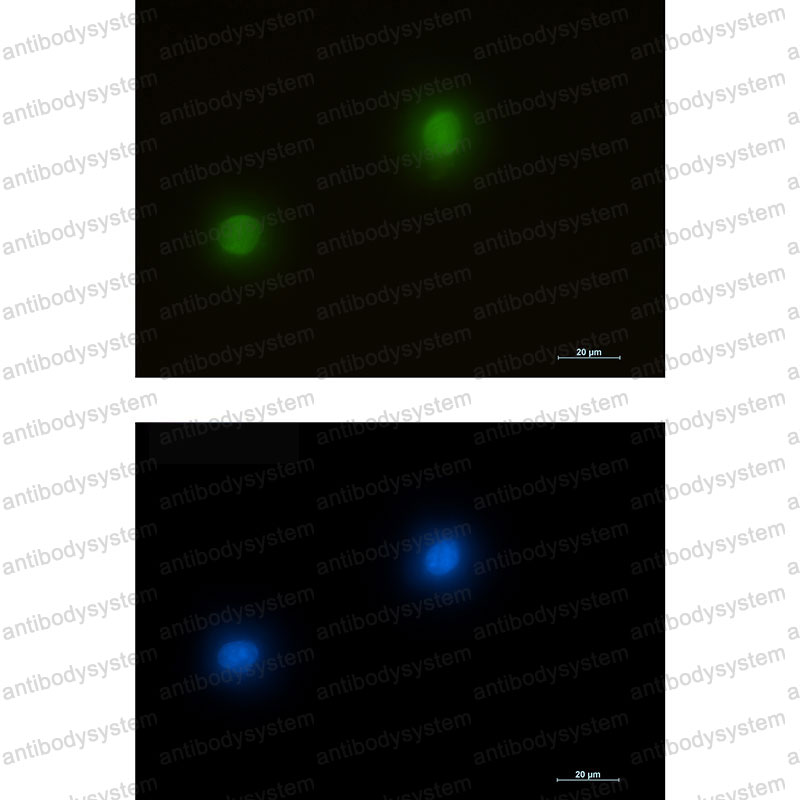 Anti-MAPK1 Antibody (R1T59)