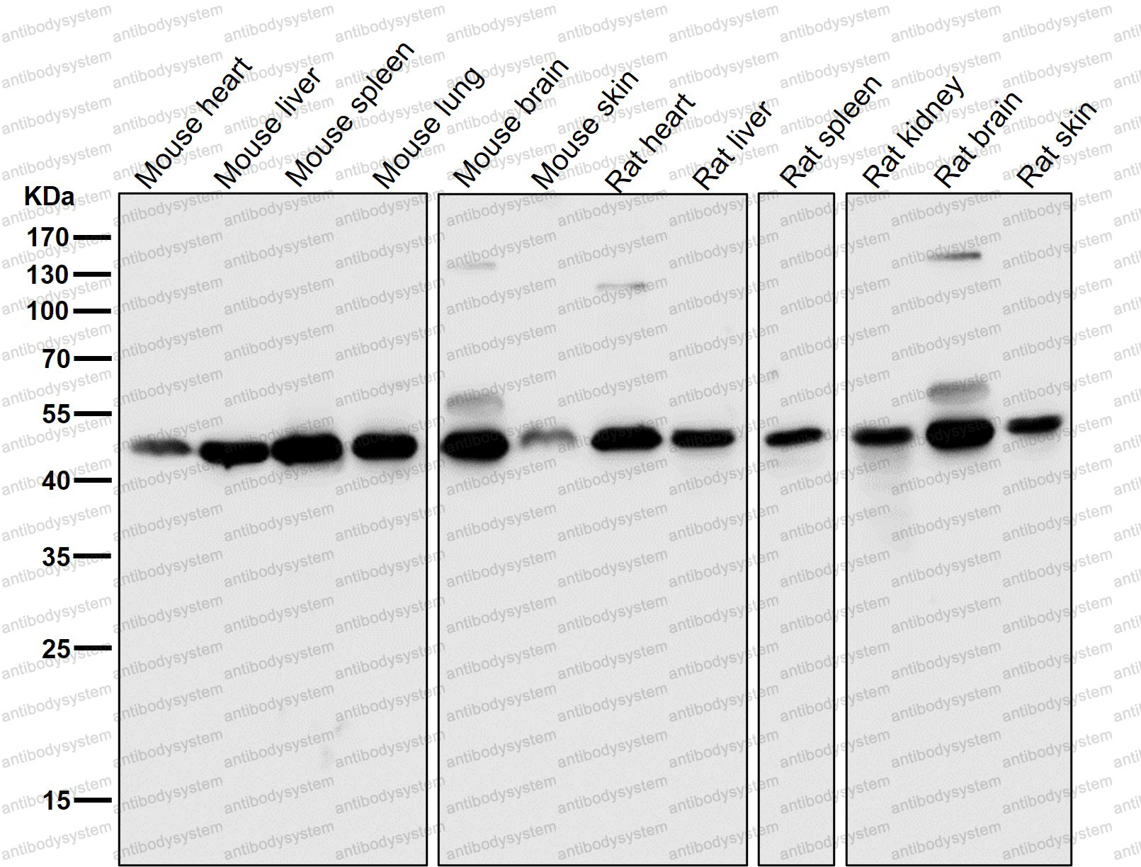 Anti-DUSP1 Antibody (R1T60)