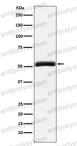 Anti-GP88/GRN Antibody (R1T61)