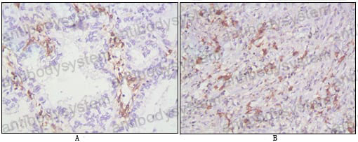 Anti-CD38/ADPRC 1 Antibody (R3H59)