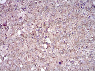 Anti-CD38/ADPRC 1 Antibody (R3H60)