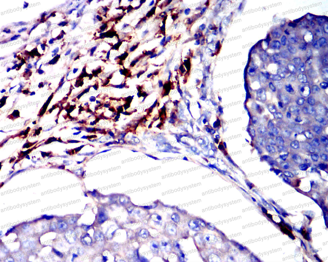 Anti-CD38/ADPRC 1 Antibody (R3H61)