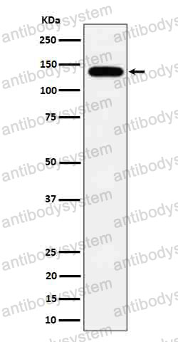 Anti-TPP2 Antibody (R1B84)