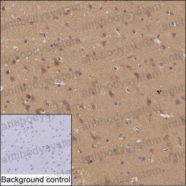 Anti-IMPA1 Antibody (R3H70)