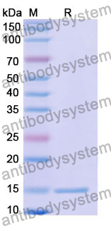 Anti-Human CTGF/CCN2 Nanobody (SAA1211)