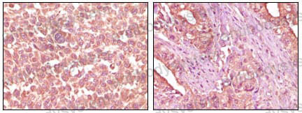 Anti-EPHA2 Antibody (R3H72)