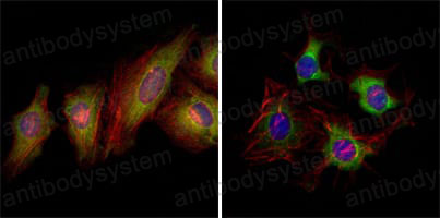 Anti-EPHB2 Antibody (R3H73)