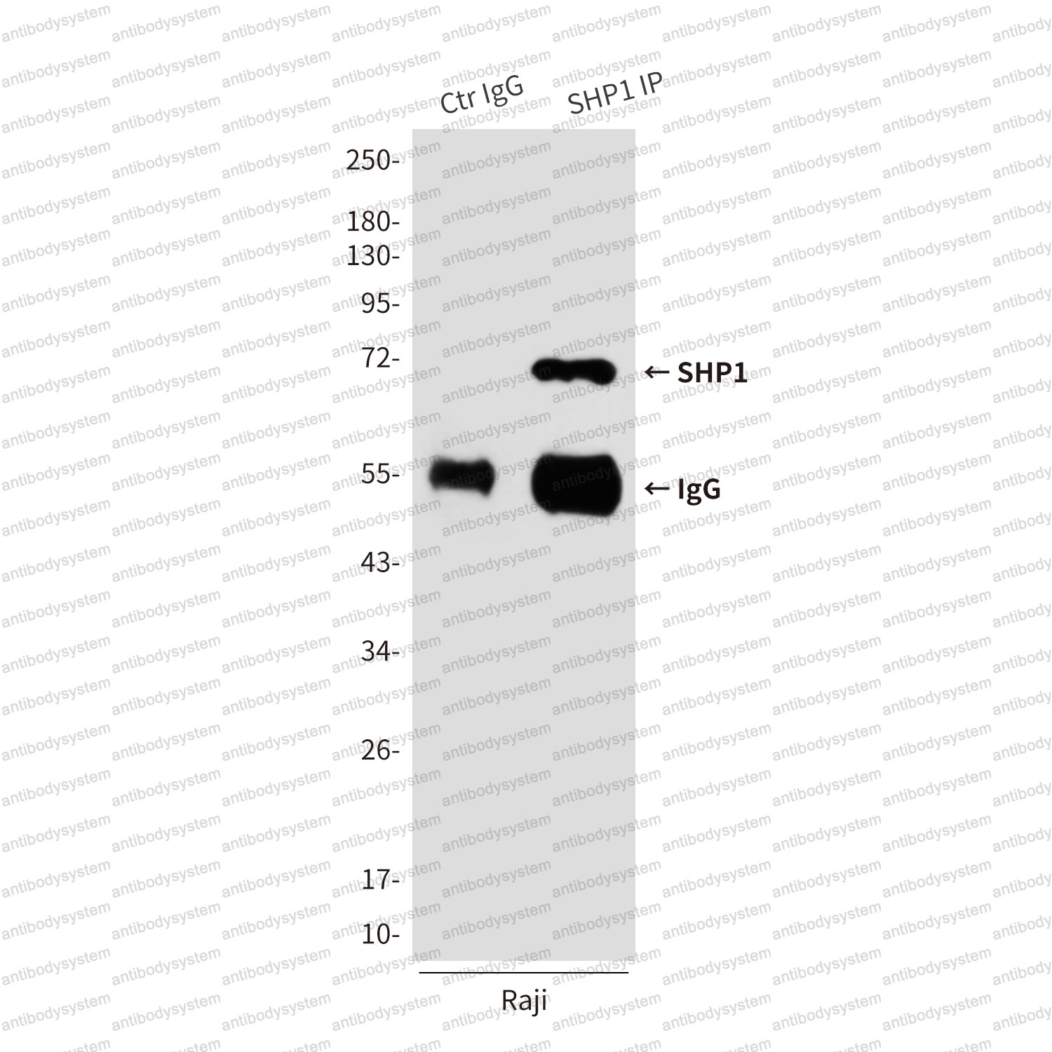 Anti-PTPN6 Antibody (R3H75)