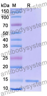 Anti-Human IL12B/IL-12 p40/NKSF2 Nanobody (SAA1159)