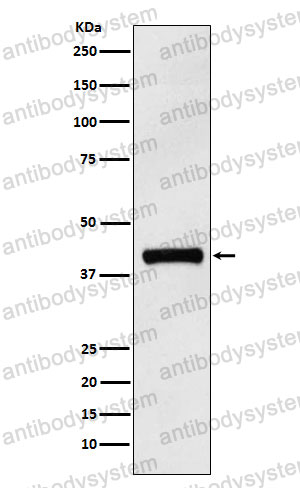 Anti-IL12B/IL-12 p40/NKSF2 Antibody (R1T72)