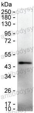 Anti-IL12B/IL-12 p40/NKSF2 Antibody (R3H78)