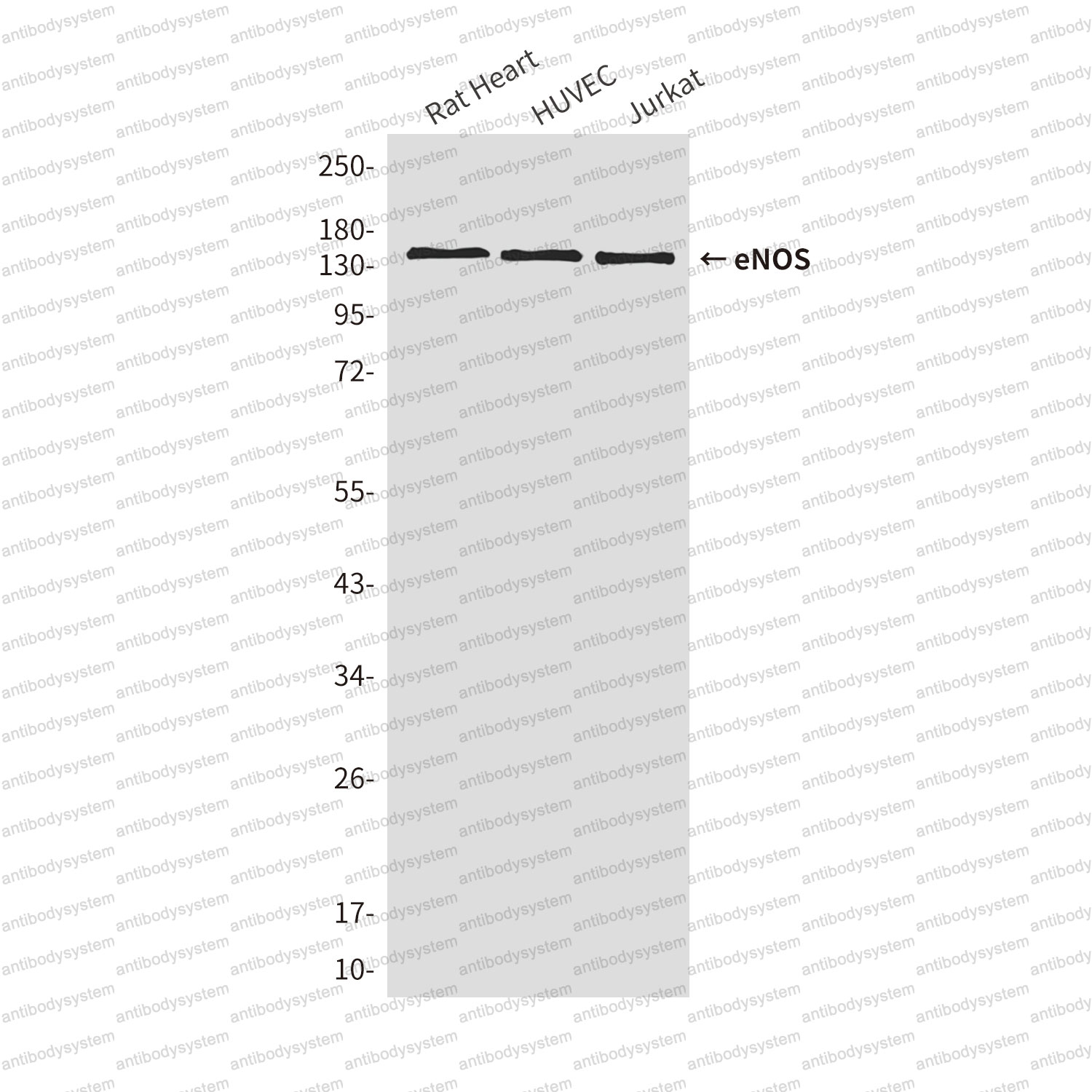Anti-NOS3/eNOS Antibody (R3H80)