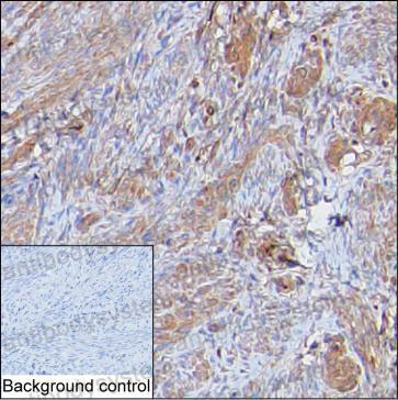 Anti-LMOD1 Antibody (R3H82)