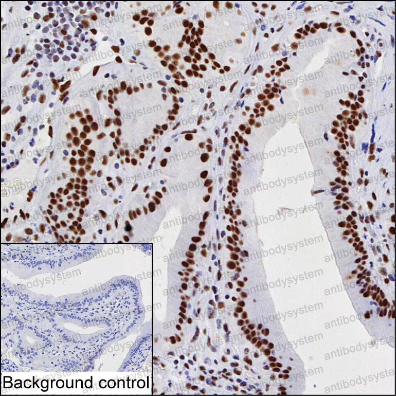 Anti-PML Antibody (R3H84)