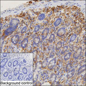 Anti-MARCKS Antibody (R3H87)