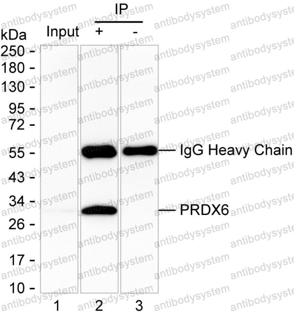 Anti-PRDX6 Antibody (R3H88)
