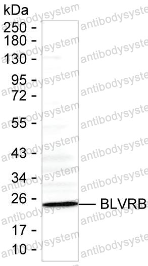 Anti-BLVRB Antibody (R3H90)