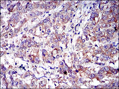 Anti-CD6 Antibody (R3H93)