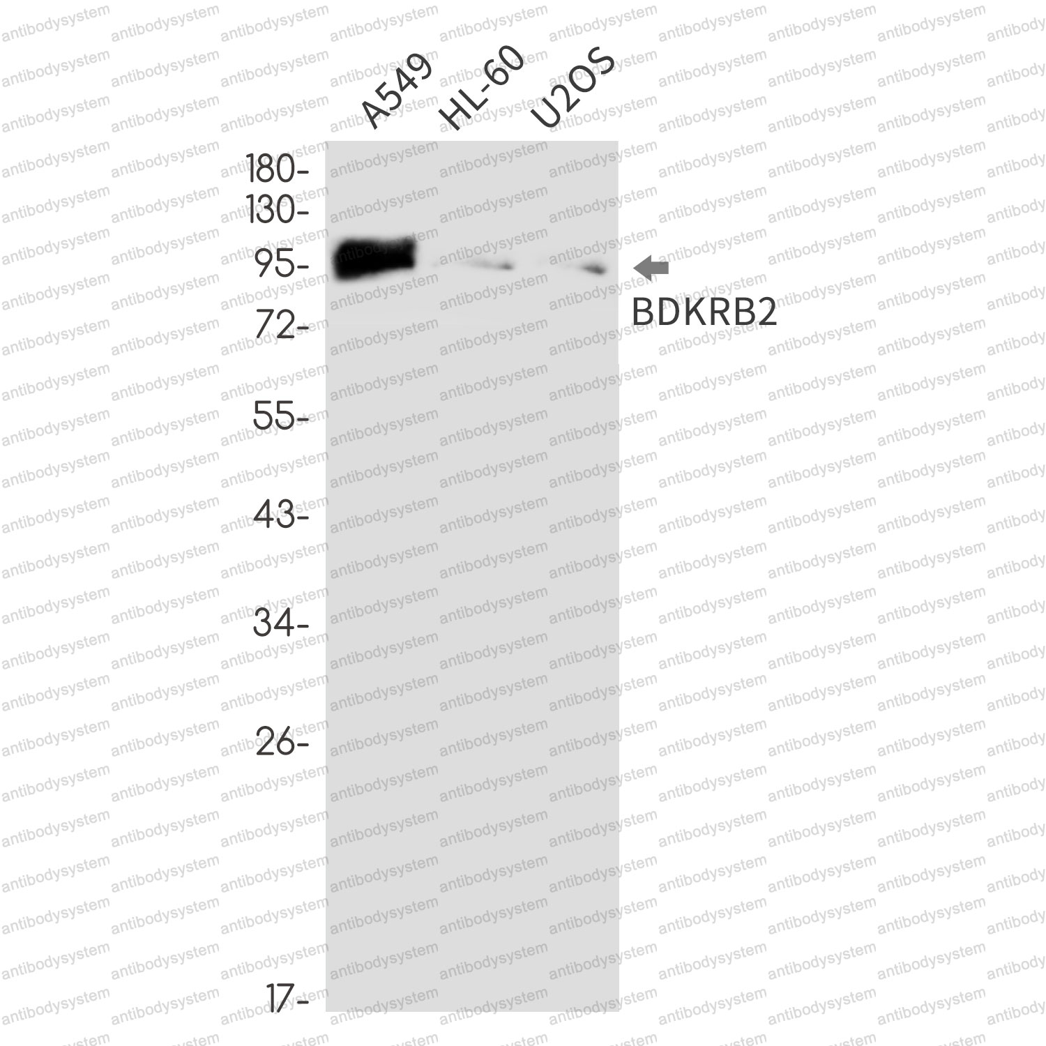 Anti-BDKRB2 Antibody (R1T98)