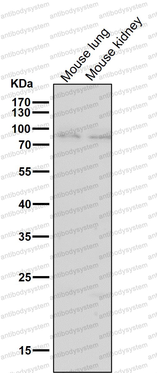 Anti-BDKRB2 Antibody (R1T97)