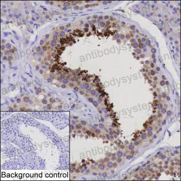Anti-HMOX2 Antibody (R3J01)
