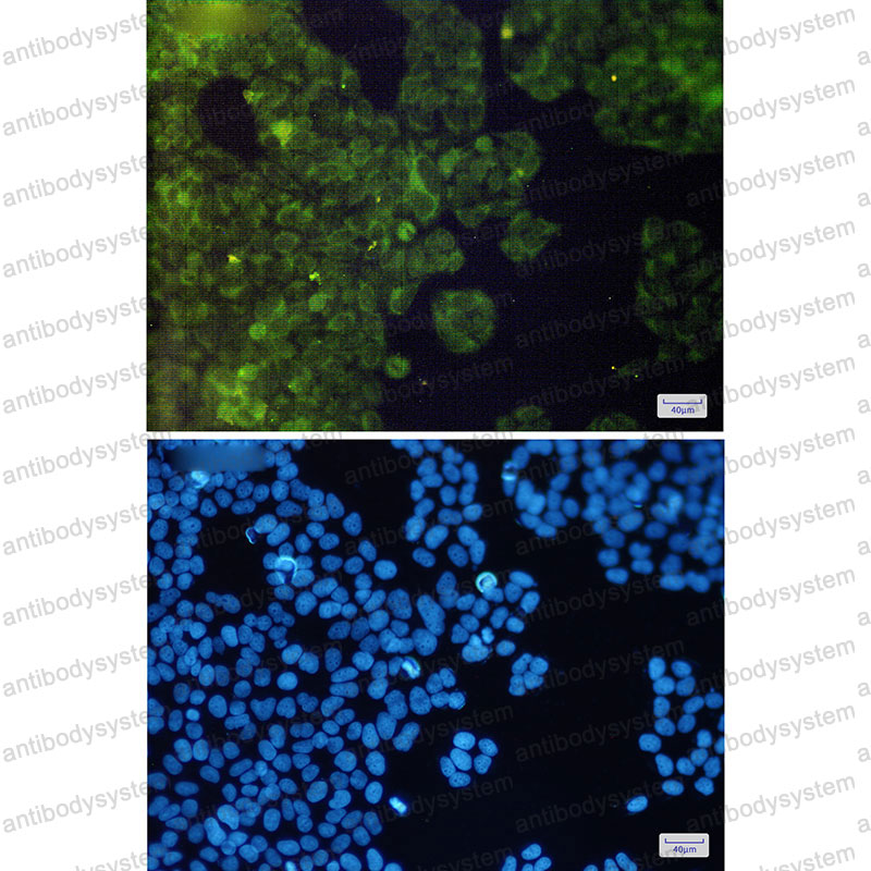 Anti-ADSS2 Antibody (R1U01)