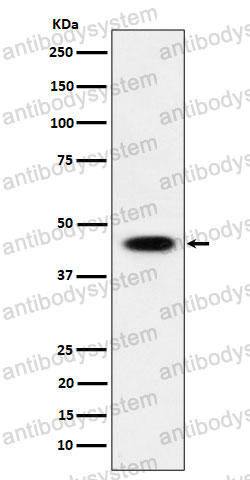 Anti-ADSS2 Antibody (R1T99)