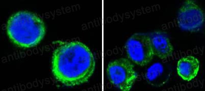 Anti-AXL/UFO Antibody (R3J02)