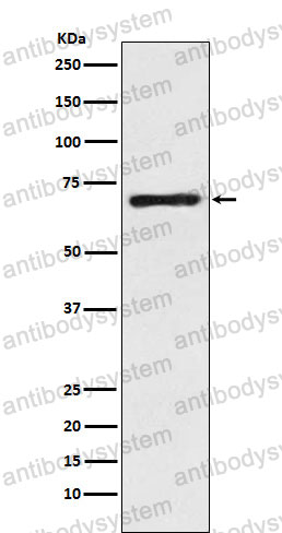 Anti-SLC6A1/GAT1 Antibody (R1U03)