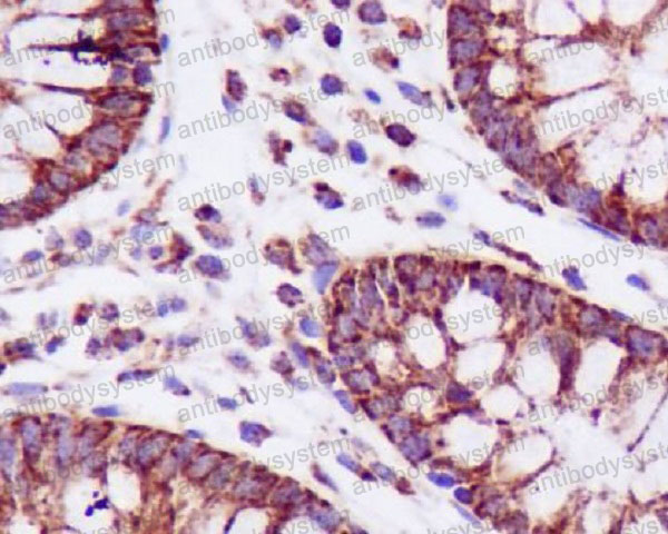 Anti-TSPO/PBR Antibody (R1B60)
