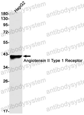 Anti-AGTR1 Antibody (R1U07)