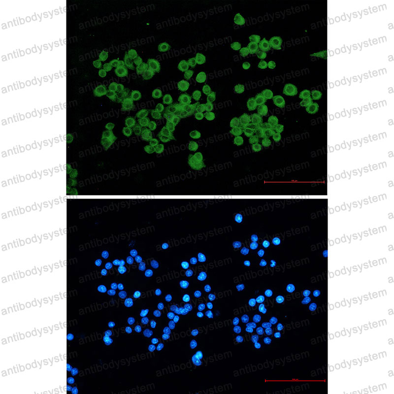 Anti-CLIP1 Antibody (R1U10)
