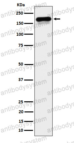 Anti-CLIP1 Antibody (R1U09)
