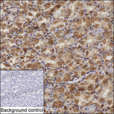 Anti-ALDH3A1 Antibody (R3J05)