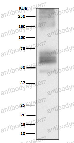 Anti-SSTR1 Antibody (R1U11)