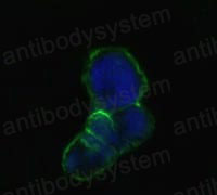 Anti-LCN1 Antibody (R3J08)
