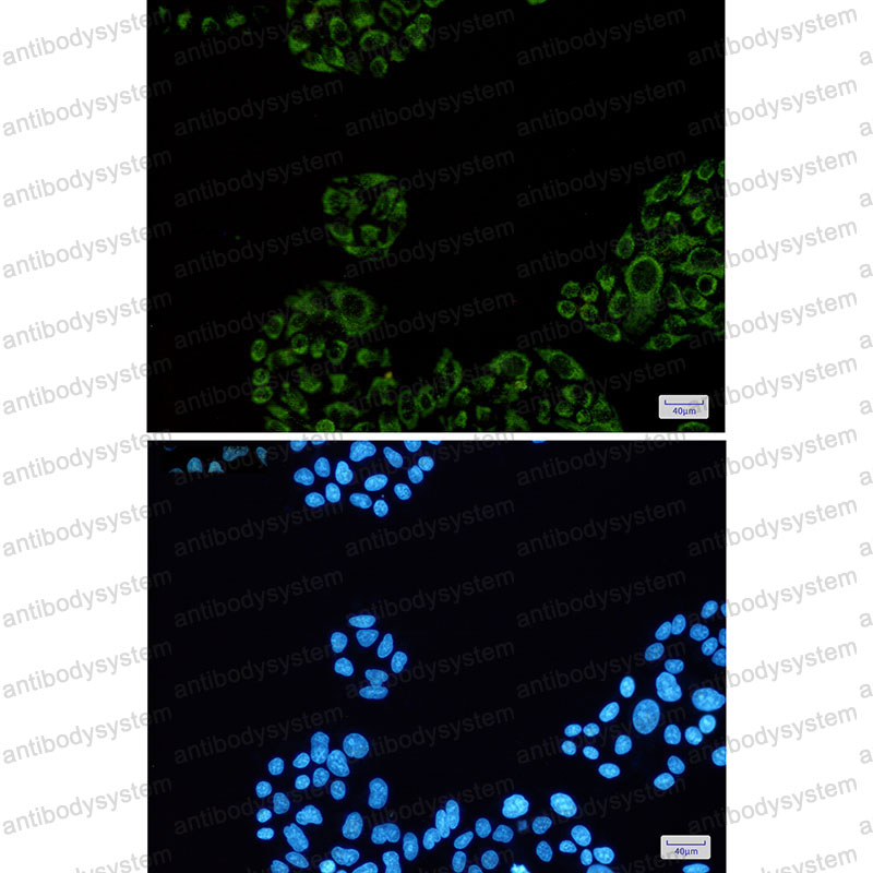 Anti-SDHA Antibody (R1U12)