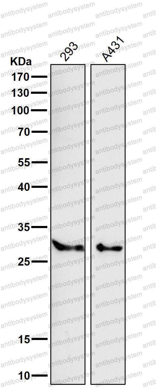 Anti-SRD5A2 Antibody (R1U14)
