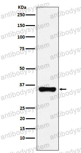Anti-HOXA9 Antibody (R1U15)