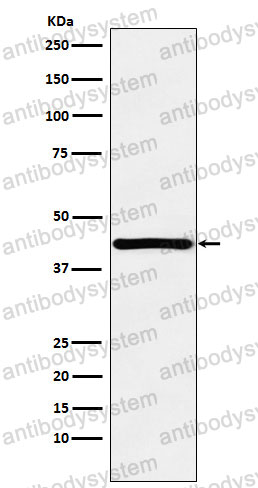 Anti-HOXA13 Antibody (R1U16)
