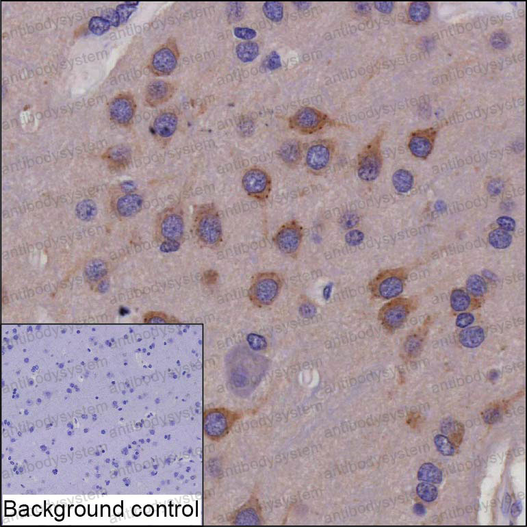 Anti-PRKAR1B Antibody (R3J12)