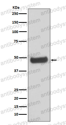 Anti-PRKAR2B Antibody (R1U17)