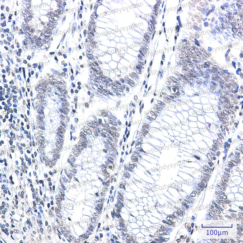 Anti-CPS1 Antibody (R1U19)