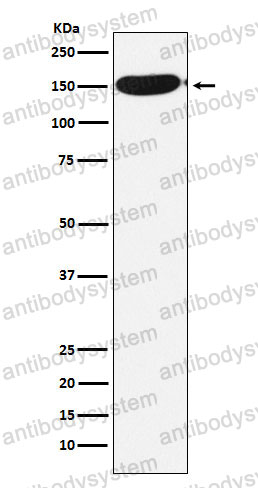 Anti-CPS1 Antibody (R1U18)