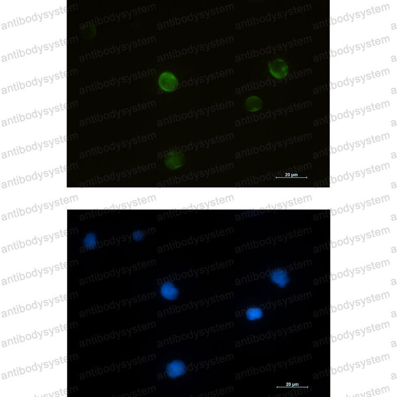 Anti-RRM2 Antibody (R1U21)